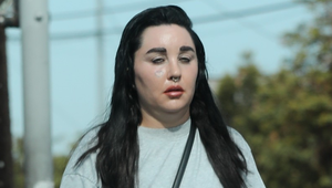 Amande Bynes nepomohla ani psychiatria: Spuchnutá a mimo sa túlala ulicami