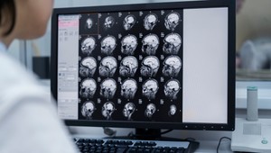 Prelomová štúdia: Čo odhalil mozog v posledných chvíľach života?