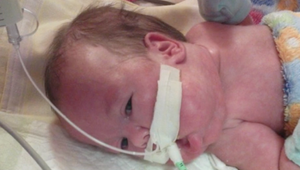 Malej Emke spôsobil nedostatok kyslíka počas pôrodu fatálne následky. Teraz rodičia žiadajú milión od nemocnice