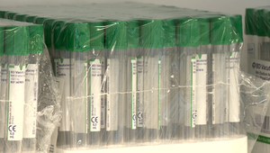 Kedy k nám dorazí vakcína a prečo nie už tento rok?