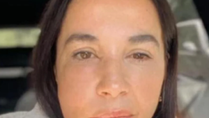 Krásna česká herečka vydesila fotkou znetvorenej tváre! TOTO sa jej stalo!