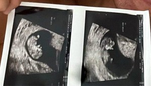 Dvojičky na ceste! Megahviezda sa pochválila fotkou z ultrazvuku!