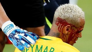 Neymar strelil už 300 gólov. Proti Bolívii prišiel takmer o oko