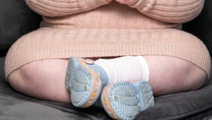 5-ročné dievčatko váži už 44 kíl: Jej mama sa bojí, že sa preje na smrť