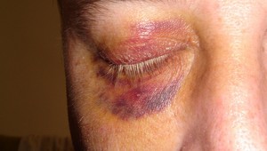 Zbil matku a vyhrážal sa jej zabitím