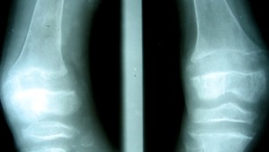 V Británii sa šíri krivica, chudobní nemajú na kvalitné potraviny