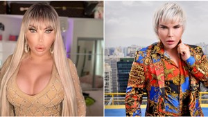 Barbie, ktorá bývala Kenom, stále nemá dosť! Neuveríte, čo si dala dramaticky zväčšiť!