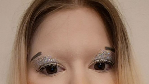 TAKTO vyzerajú najväčšie pery na svete: Miesto úst má na tvári gigantické párky