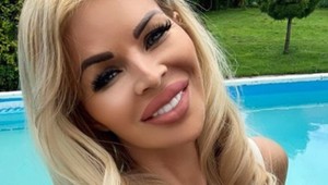 Chce inšpirovať nespokojných: Silvia Kucherenko sa už za plastiky nehanbí!