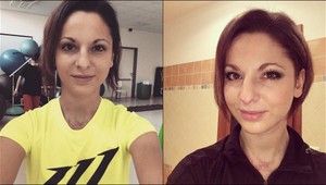 Neuveriteľný príbeh mladej Češky. Choroba ju pripravila o nohy a prsty, ale chuť do života nestratila