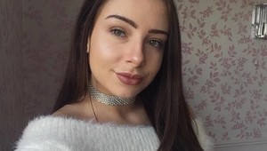 Problém, ktorý trápi mnohé ženy: TOTO skrývala pod mejkapom!