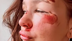 Po smrti partnera si našla hviezda speváckej súťaže novú lásku! No viac šokovala dobitou tvárou!