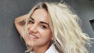 Má nový nos, prsia, upravené viečka a používa botox: Pamätáte si, ako vyzerala Dara Rolins pred rokmi?