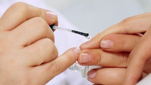 Biele fľaky, lámavosť či ryhy: Čo signalizujú vaše problémy s nechtami?