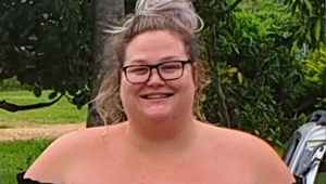 Ako sa môže vaša tvár zmeniť, keď schudnete 87 kilogramov? Naozaj neuveriteľne!