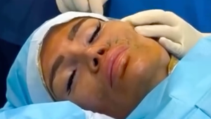 Soukupova exfrajerka priznala ďalší zákrok! Zábery sú len pre silné nátury!