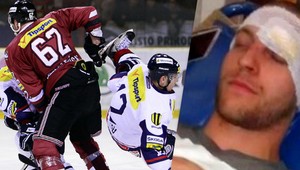 ZÁZNAM. Nebol som opitý, bráni sa Bambúch po útoku