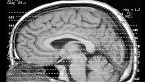 Bojíte sa, že vás porazí? Takto sa tomu môžete vyhnúť