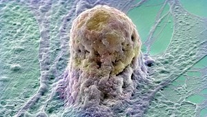 Kmeňové bunky - liek na všetko! Vraj sme k nemu blízko