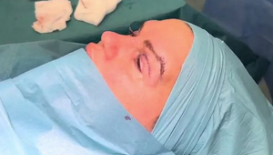 Speváčka chcela vyzerať lepšie, fanúšikov ale VYDESILA! Operácia priniesla komplikácie!