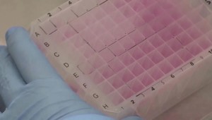 Na Slovensku potvrdili 5 prípadov opičích kiahní