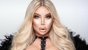 Jessica Alves prvýkrát bez mejkapu: Takto vyzerá po 75 operáciách