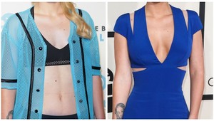 Priznala sa! Ktorá známa tvár si dala nedávno spraviť silikóny?