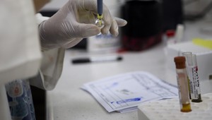 V USA zaznamenali prvý prípad nakazenia vírusom zika pohlavným stykom