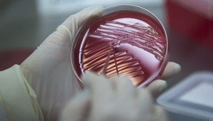 Jedovatá príroda? Týmto zvieratám sa vyhýbajte