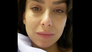 Manželka Aleca Baldwina má za sebou operáciu. A chce sa pokúsiť o ďalšie dieťa