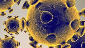 Analýza COVID-19 za august: Z týchto krajín bolo najviac importovaných prípadov