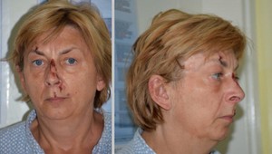 Chorvátska polícia stotožnila ženu so stratou pamäte, ktorú našli na ostrove Krk. Má ísť o Danielu z Trenčína