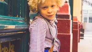 Ľudia na neho zízali a ukazovali prstom: Z 5-ročného chlapca je hviezda modelingu