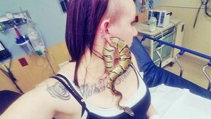 Dievčina prišla na pohotovosť so živým hadom v uchu