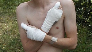 Vedci porazili chorobu motýlích krídel: Chlapec s ochorením hrá po nasadení lieku futbal!