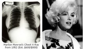 Röntgeny hrudníka Marilyn Monroe predali za 45-tisíc dolárov