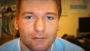 Petra (36) dobili takmer na smrť, stratil pamäť