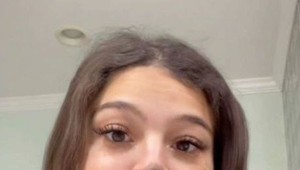 Obrovské znamienko na jej tvári sa nedá prehliadnuť: Odstránenie odmietla a neľutuje