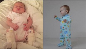 Lekári tvrdili, že nebude nikdy chodiť: Prvé kroky dievčatka vás dojmú k slzám