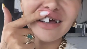 Sexi bezzubá Plačková? Ukázala svoj "vybitý" úsmev!