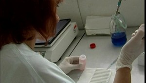 Môžete mať hepatitídu C a neviete o tom? Zákerný zápal pečene má týchto 10 príznakov