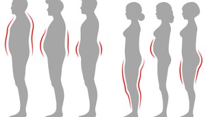 Nedarí sa vám zhodiť kilá navyše? Chudnite podľa toho, kde sa vám ukladá tuk