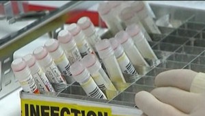 RÚVZ upozorňuje: V kraji sa vyskytla salmonela, žltačka a meningitída