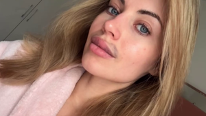 Krásna misska spravila radikálne rozhodnutie! Bolestivý návrat k prirodzenosti!