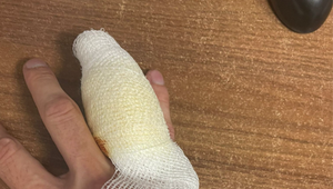 Agresívny muž dohrýzol kamaráta a potom aj policajtov