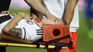 FK Kukësi po vyčíňaní fanúšikov prehral s Legiou kontumačne