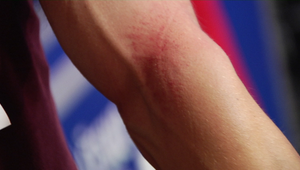 Hurá systém pri športovaní? Tieto 4 vážne poranenia si môžete spôsobiť, ak sa nerozcvičíte!