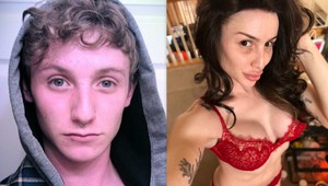 Mladík chce vyzerať ako Kardashianka: Za plastiky vysolil 50 000 libier!