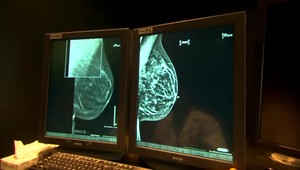 Onkologickí pacienti majú ťažkosti s parkovacími miestami