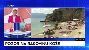 Štúdio 24: Pozor na rakovinu kože